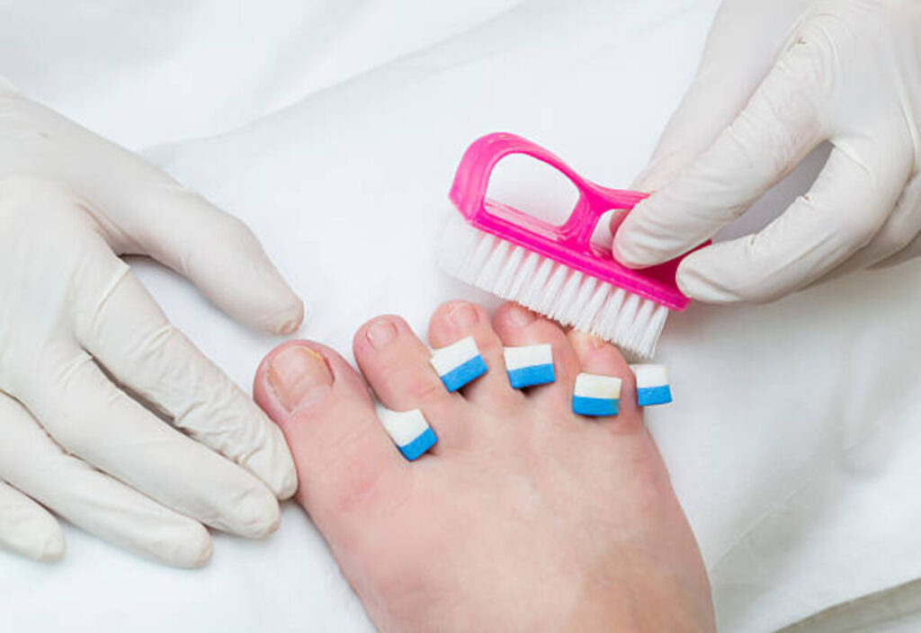 Better Fitting Footwear Prevents Ingrown Toenails